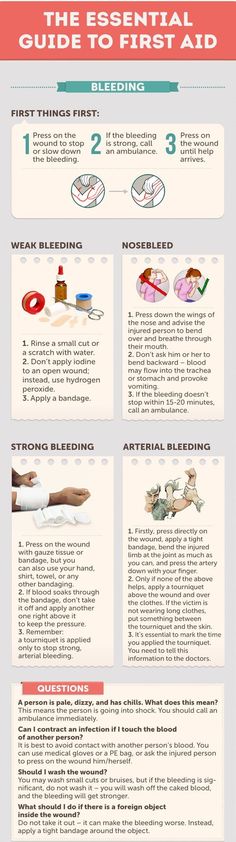 Control and Stop Bleeding - The Essential Guide. Save this guide to control bleeding at home, learn how to stop weak bleeding, nosebleed, strong bleeding and arterial bleeding. Stop severe hemorrhages with an israeli bandage: http://insidefirstaid.com/personal/first-aid-kit/what-is-and-how-to-use-israeli-bandage #bleeding #hemorrhage #emergencies First Aid Tips, Hiking Tips, After Life, Aid Kit, Health Advice, Survival Tips, Emergency Preparedness, Survival Skills