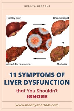 Liver Cleanse Diet, Liver Detox Diet, Liver Damage, Liver Issues, Liver Failure, Unhealthy Diet, Liver Detoxification