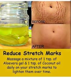 Natural Skin Care Ingredients, Hit Or Miss, Toilet Paper Rolls, Beauty Tips For Glowing Skin, Perfect Skin Care Routine, Grooming Tips