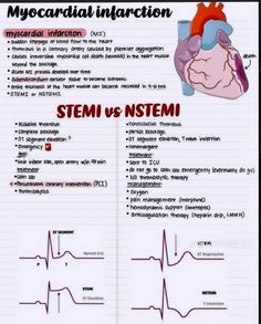 a medical manual with an image of a heart and the words stemu vs instemi