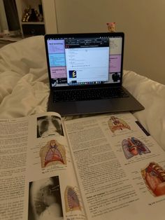 an open book with medical diagrams on it next to a lap top and laptop computer