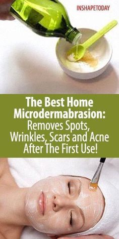 The Best Home Microdermabrasion: Removes Spots, Wrinkles, Scars and Acne After The First Use! - InShapeToday Home Microdermabrasion, Anti Aging Remedies, Smink Inspiration, Natural Anti Aging, Beauty Treatments, Skin Treatments, Beauty Secrets, Apple Cider, Beauty Care