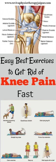 the knee pain chart shows how to get rid of knee pain and what to do with it