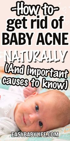 a baby laying down with the words how to get rid of baby acne naturally and important cause to know