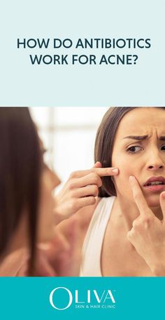 How does an antibiotic work for acne? Here is an article on benefits, usage, doses and side effects from an expert dermatologist. Skin And Hair Clinic, Acne Overnight, Acne Treatments, Acne Face Wash, Home Remedies For Acne, Treat Acne, Acne Scar Removal, Acne Remedies