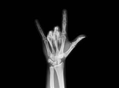 an x - ray image of a person's hand holding up the peace sign