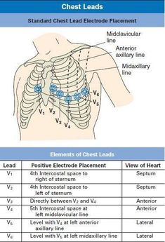 the chest is shown with different types of electrodes and their corresponding locations in it