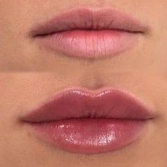 Lip Fillers Juvederm, Lip Permanent Makeup, Lips Inspiration, Permanente Make-up, Face Fillers, Botox Lips, Facial Fillers, Lip Augmentation, Facial Aesthetics