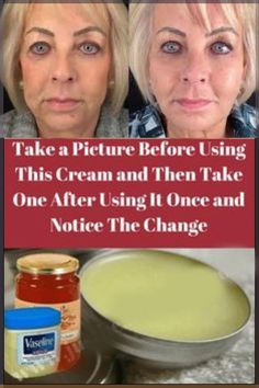 Get rid of skin wrinkles naturally with this herbal remedy >>Watch FREE VIDEO<< Glowing Radiant Skin, Home Remedies For Hair, Beauty Tips For Face, Natural Therapy, Beauty Remedies, Skin Complexion, Anti Aging Skin, Natural Beauty Tips, Wrinkle Cream