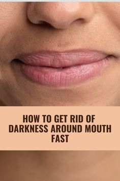 Discover quick solutions to get rid of darkness around your mouth fast. Achieve a brighter, even-toned complexion efficiently! Reduce Darkness Around Mouth, Around Mouth Darkness, Dryness Around Mouth, Dark Upper Lip Remedies, How To Get Rid Of Darkness Around Mouth, How To Get Rid Of Mustache Women, How To Get Rid Of Upper Lip Darkness, How To Remove Darkness Around Lips, How To Remove Dark Area Around Mouth