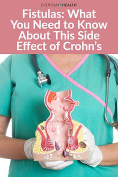 Crohns Symptoms Signs, Chrones Disease Diet, Chrons Disease Diet, Crohns Symptoms, Ostomy Life