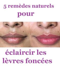 Retrouvez 5 remèdes naturels pour éclaircir les lèvres foncées, et avoir des lèvres roses et pulpeuses. Recettes naturelles pour éclaircir les lèvres sombres et gercées.. Health Signs, Clear Skin Tips, Lips Makeup, Dark Lips, Chapped Lips, Face Skin Care, Skin Tips, Pink Lips, Face Skin