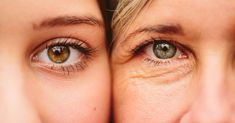 If you’re bothered by droopy eyelids and sagging skin, nonsurgical treatments like fillers or injections can help you look more youthful — as can certain surgical options Dry Eyes Causes, Skin Tightening Treatments, Skin Care Routine For 20s, Crepey Skin, Best Eye Cream, Eye Anti Aging, Eyes Problems, Eye Wrinkle, Puffy Eyes