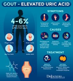 Uric Acid Symptoms, Uric Acid Diet, Uric Acid Crystals, Uric Acid Levels, Healing Waters, Uric Acid, No Carb Diets, Skin Health, Back Pain