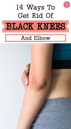 14 Ways To Get Rid Of Black Knees And Elbow: Dark knees and elbows result from higher level of melanin than the other areas of the body. Sun damage, wear and tear, and friction can cause dark knees and elbows. Do not worry as this discoloration of skin is not a cause for concern or medical risk. How To Get White Knee And Elbow, How To Get Smooth Elbows, How To Get Rid Of Ashy Knees And Elbows, How To Fix Dark Knees, Rough Elbows How To Get Rid Of, How To Get Rid Of Black Knees, Black Elbows Get Rid Of, Dry Elbows How To Get Rid Of, How To Get Rid Of Ashy Knees