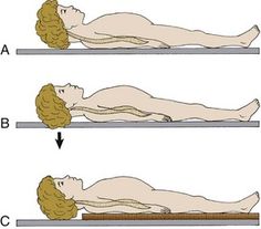 Prehospital Immobilization | Veterian Key Pediatrics