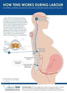 the diagram shows how tens works during labor