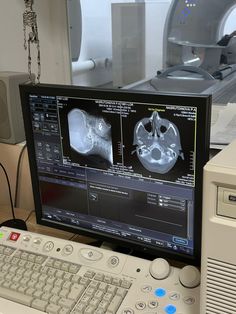 an x - ray image is displayed on a computer screen