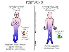 two different types of postures