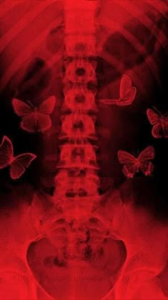 an x - ray image of a man's back with butterflies flying around it