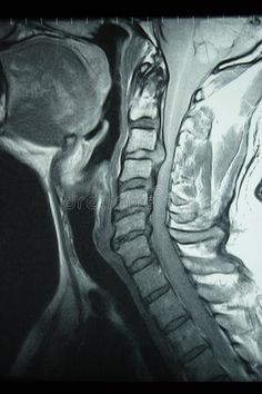 an x - ray image of the knee shows what appears to be jointed with one another