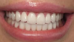 New year vision board, perfect smile, dental health, white teeth Crush Signs, Teeth Aesthetic, Pretty Teeth, Beautiful Teeth, Wish Board, Porcelain Veneers, Perfect Teeth, Vision Board Images, Smile Teeth