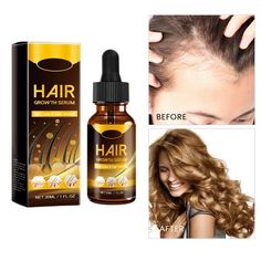 Wuvpotd Hair Follicle Care Hair Oil Moisturizes Softens And Makes Hair Shiny 30ml Features: Fill the with the oil. Apply the oil directly to the scalp, paying extra attention to problem areas. Spread the oil evenly across the scalp. Massage the scalp using your fingertips or a massager. Leave the oil on overnight or for a minimum of two hours. this process three times a week. Product Description: Hair follicle care hair oil moisturizes, softens and makes hair shiny 30ml Material: Plastic Color: Hair Growth Serum, Hair Sale, Scalp Massage, Care Hair, Hair Follicle, Shiny Hair, How To Make Hair, Hair Oil, Hair Growth