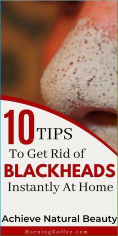 Blackheads, like many other acne forms, can be stubborn to remove. But don't worry, in this post we've researched and gathered the most effective ways to remove blackheads quickly at home. Tips on how you can easily get rid of blackheads pretty fast at home. how to get rid of blackheads, blackhead removal, naturally remove blackheads, beauty tips, beauty Pimples Under The Skin, Blackheads On Nose, Rid Of Blackheads, Blackhead Mask, Cold Sores Remedies, How To Get Rid Of Pimples, Natural Sleep Remedies, Natural Cold Remedies, Get Rid Of Blackheads