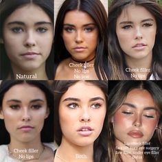 Madison Beer plastic surgery, cheek filler Jaw Implant Before And After, Brows And Lips Makeup, Madison Beer Plastic Surgeries, Jaw And Chin Filler, Filler Nose Job Before After, How To Lift Your Eyes, Hip Filler Before And After