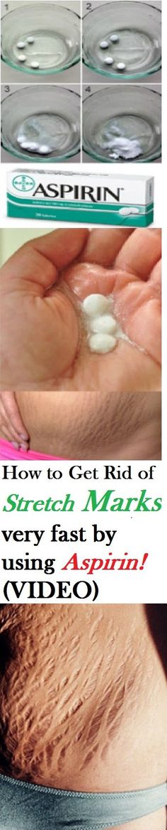 Smiles Happy People, Hair Growth Home Remedies, Today Tips, Home Remedies For Acne, Cold Home Remedies, Upset Stomach, Diy Beauty Recipes, Skin Remedies, Skin Skincare