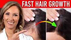 3 Things You Can do For Crazy Hair Growth | Dr. Janine Hair Growth Faster, Crazy Hair, 3 Things, You Can Do, Canning, Hair, Hair Care Tips