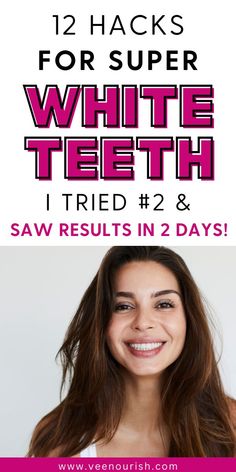 Dental Health Teeth Whiting At Home Hydrogen Peroxide, Best Way To Whiten Teeth At Home, Home Remedies For Teeth Whitening Diy, Natural Ways To Whiten Teeth, How To Bleach Your Teeth At Home, Home Made Teeth Whitening, Natural Tooth Whitener, Homemade Whitening Toothpaste, Diy Teeth Whitening At Home