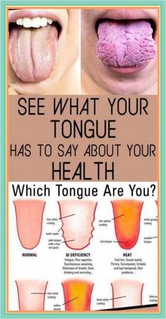 What Your Tongue is Trying to Tell  - You About Your Health  !!! by adeu borex | This newsletter was created with Smore, an online tool for creating beautiful newsletters for educators, businesses and more Tongue Cleaner, Feeling Hot, The Tongue, Body Organs, Shortness Of Breath, Medical Practice, Unwanted Hair