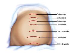 an image of the back of a person's stomach with labels on its side