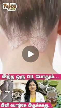 PaleoLife on Instagram: "பொடுகு எண்ணெய் தயாரிக்கும் ரகசியம் முறை
Dr.Sharmika

#healthtips #health #healthylifestyle #healthyliving #healthyfood #fitness #healthy #nutrition #wellness #weightloss #healthyeating #healthcare #healthandwellness #healthiswealth #healthylife #skincare #beautytips #beauty #vegan #covid #fitnessmotivation #stayhealthy #healthbenefits #healthytips #ayurveda #holistichealth #diet #food #selfcare #homeremedies" Diet Food, Healthy Nutrition, Healthy Tips, Holistic Health, Ayurveda, How To Stay Healthy, Home Remedies, Health Benefits, Beauty Skin