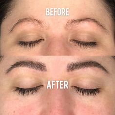 ForBrow | Eyebrow Growth Enhancing Serum by Forchics - ForChics Bedroom Black Wallpaper, Growing Eyebrows Thicker, Eyebrow Serum Growth, How To Grow Thick Eyebrows Naturally, Nature Aesthetic Bedroom, Best Brow Growth Serum, Grande Eyebrow Serum, Deck Stain Ideas, Porch Ideas Entrance