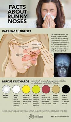 Nasal discharge can be an indicator of health. Mucus Color, Paranasal Sinuses, Medical Knowledge, Runny Nose, Health Plan, Health Info, Health Advice, Health Facts, Health Remedies