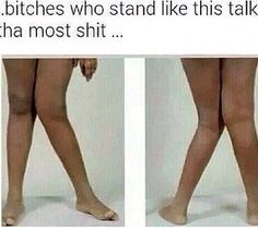 two pictures of the legs and ankles of a woman with no shoes, one showing her bare