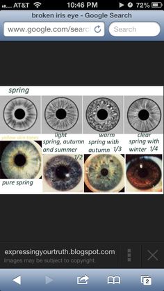 . Color Wheel Brown Eyes, Eye Color Genetics, Maximalist Closet, Broken Iris, Color Analysis Eye Pattern, Summer Eye Pattern Color Analysis, Broken Iris Eye, Grey Iris Eye, Iris Eye