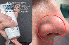 Nose Blackheads, Nose Pores, Dermatological Skin Care, Beauty Remedies, Roche Posay, La Roche Posay, Beauty Ideas, Face Skin Care, Skin Care Treatments