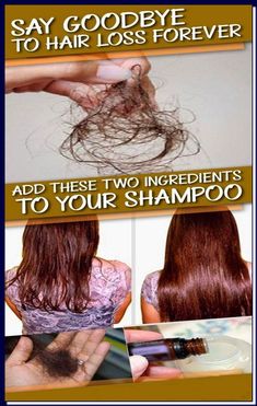 Grow New Hair, Hair Remedies, Natural Beauty Tips, Shampoos, Hair Care Tips, Hair Health, Grow Hair, Hair Skin, Say Goodbye