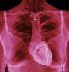 an x - ray shows the heart and lungs in this image, it appears to be red