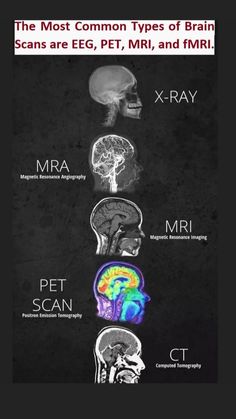 the brain is shown with different types of mris and their functions in each section