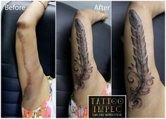 before and after photos of a woman's arm with tattoos on it, showing the removal