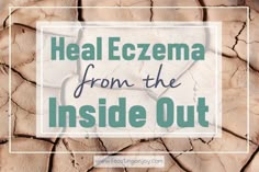 Heal Your Eczema from the Inside Out | Feasting On Joy Contact Dermitis Hands, Ezcema Diet, Holistic Remedies, 2023 Vision, Healing Food, Holistic Nutrition, Cartoon Girl, Top Pins, Natural Treatments