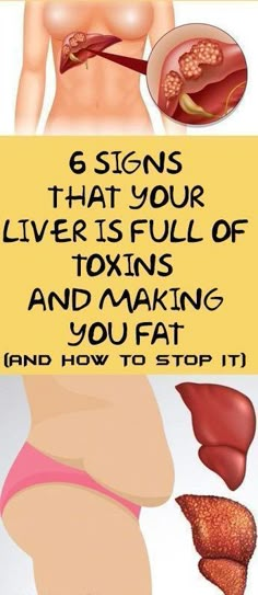 Health Signs, Liver Support, Healthy Liver, Diy Beauty Recipes, Proper Diet, Healthy Lifestyle Tips, Detox Smoothie, Stop It, Health Remedies