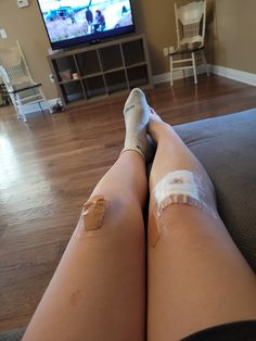 the legs of a woman with bandages on them are sitting in front of a tv