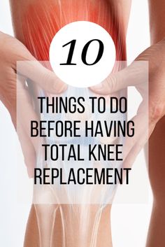 These helpful tips will allow you to be prepared for a total knee replacement surgery. Pre Knee Replacement Exercises, Knee Replacement Recovery Tips Physical Therapy, Exercises Before Knee Replacement, Knee Surgery Recovery Tips, Bursitis Knee, Surgery Prep