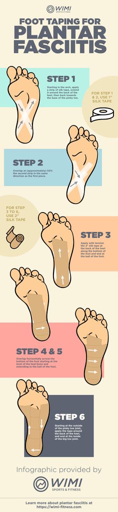 . Read more in http://natureandhealth.net/ More Facitis Plantar, Kinesiology Taping, Body Fitness, Foot Pain, Health Info, Massage Therapy, Young Living, Health Remedies, Herbal Remedies