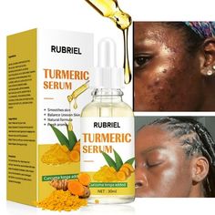 Turmeric Essence Can Mildly Moisturize The Face, Fade Fine Lines, And Whiten Aging Skin 30ml Features: Advanced Antioxidant Serum An indispensable nutrient for production, advanced designed to MOST common signs of aging including brightness, firmness, fine lines, wrinkles, dark spots & sun spots. fresher looking skin, improved tone and -ty, smaller pores, less breakouts, fine lines and dark spots. Product Description: 1*Essence Size: 30 mL.  Color: Yellow. Turmeric Facial, Dark Spots On Face, Anti Aging Face Serum, Smaller Pores, Antioxidant Serum, Dark Spot Corrector, Anti Aging Wrinkles, Vitamins For Skin, Skin Care Serum